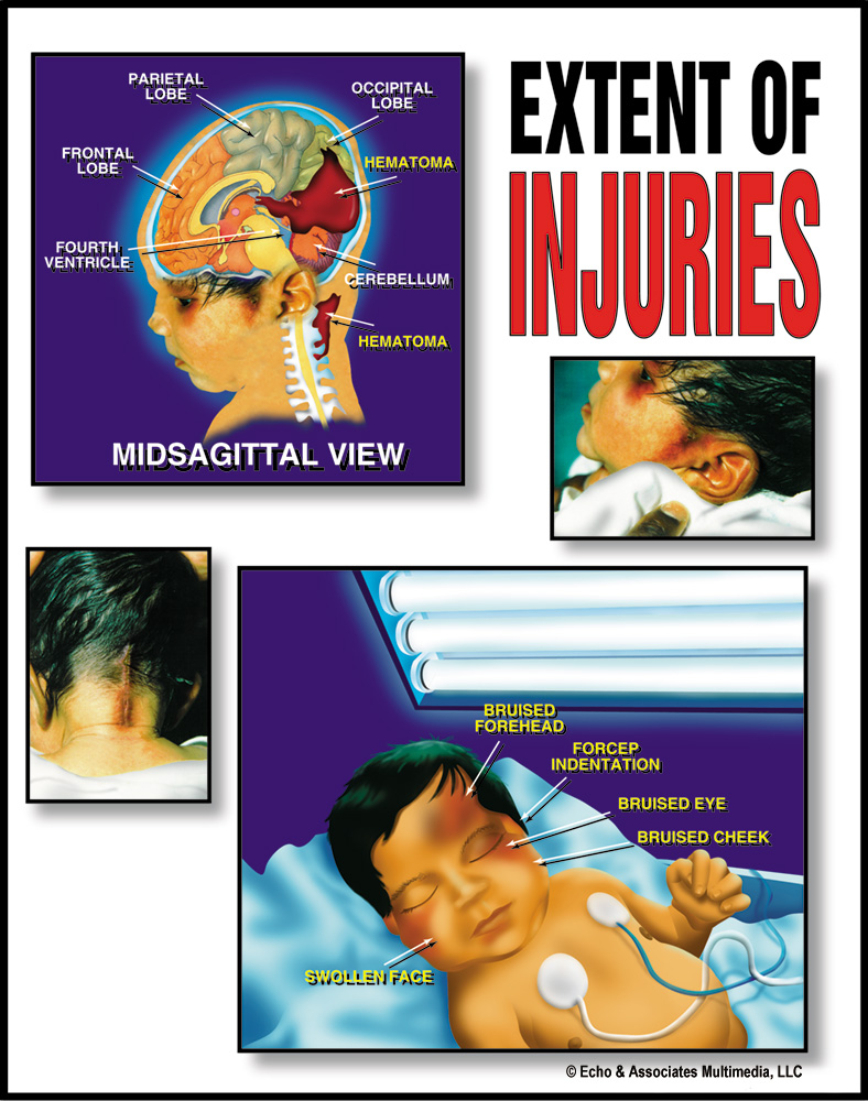 Infant Medical